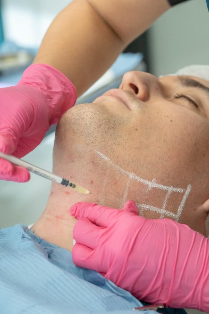 Procedimiento de Mesolipopapada en la clínica estética
